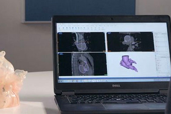 Laptop on a desk with Mimics showing anatomy scans