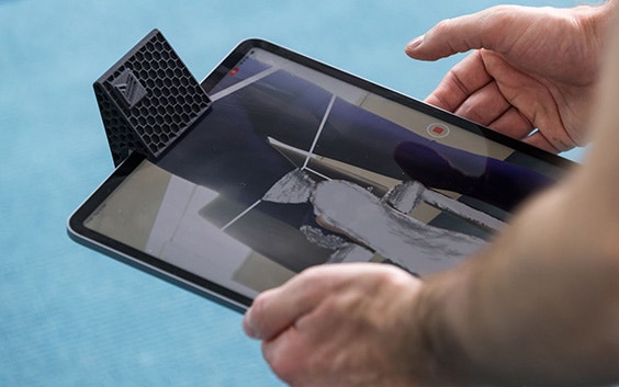 A person holds an iPad showing the scan of a patient’s foot.