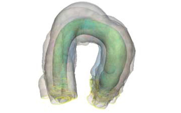 Digital image of anatomy in medical software