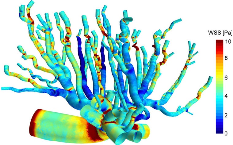 cimq-placental-blood-flow-modeling-4.jpg