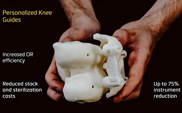 Two hands holding 3D-printed personalized knee guides 