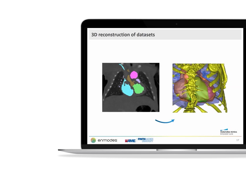 ssd-cardiovascular-3d-reconstruction-datasets.jpg