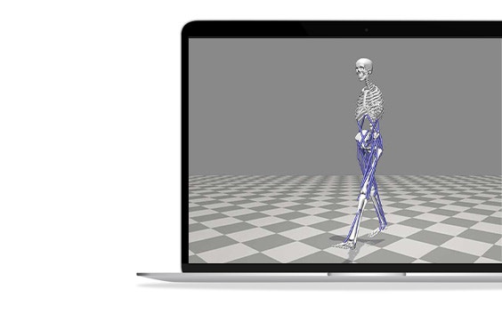 Virtual image of a skeleton walking with purple sections on the legs and pelvis shown in a laptop screen