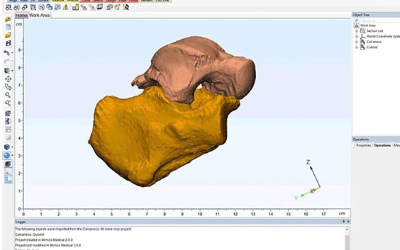 Imagen digital de la anatomía ósea en un software