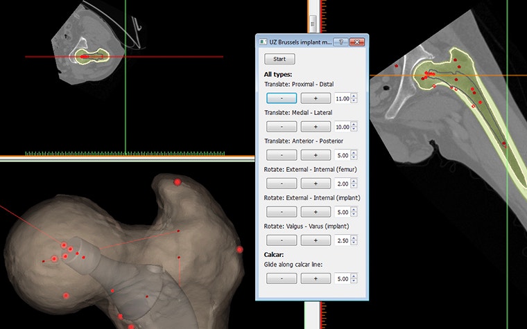 Screen showing user-friendly interface in the Mimics Innovation Suite 