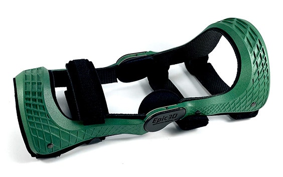 Custom 3D-printed brace by Berretta Medical Inc.