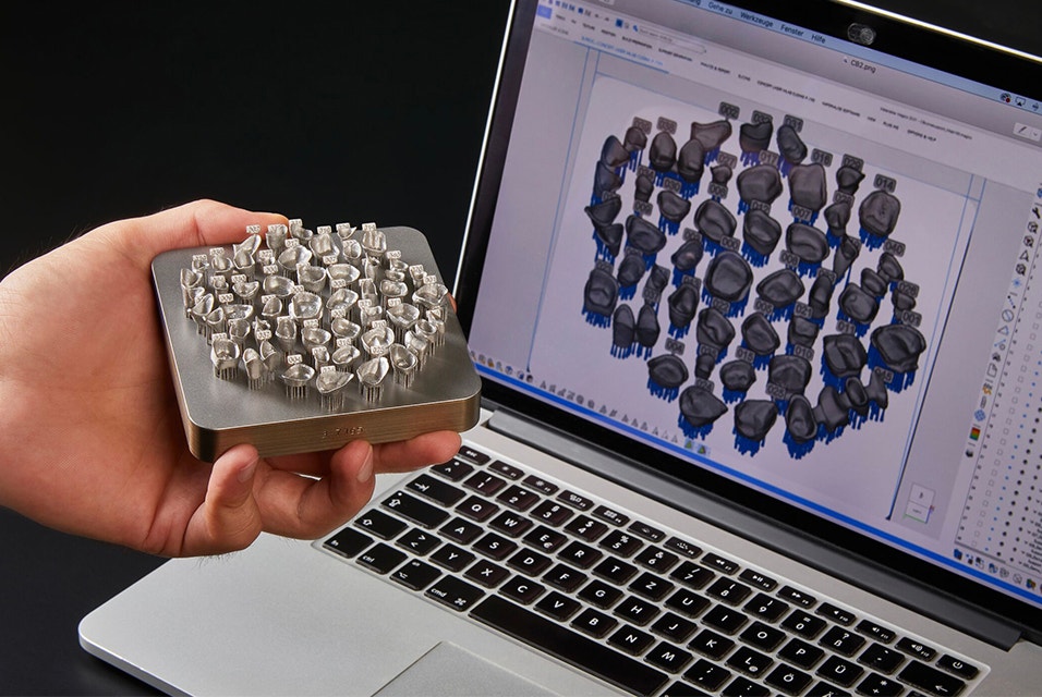Persona que sostiene piezas dentales impresas en 3D en una superficie de impresión frente a un ordenador con el módulo dental