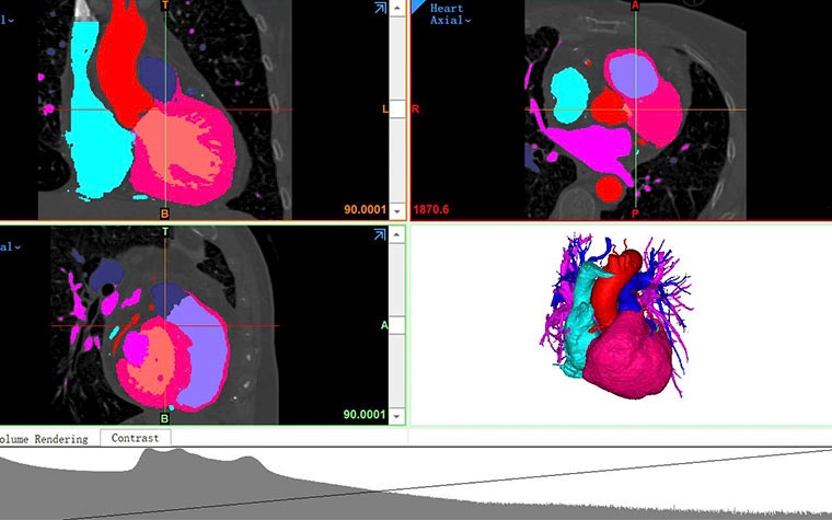 Screenshot of heart anatomy in medical software