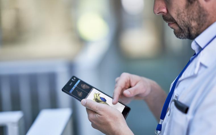 Doctor checking preoperative shoulder planning on his phone