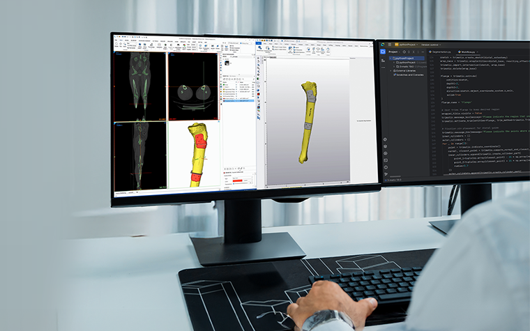 A view over the shoulder of a person working at a desk with two monitors: one showing a script in Python, and the other displaying patient scans, segmented anatomy, and a personalized surgical guide design in Materialise Mimics