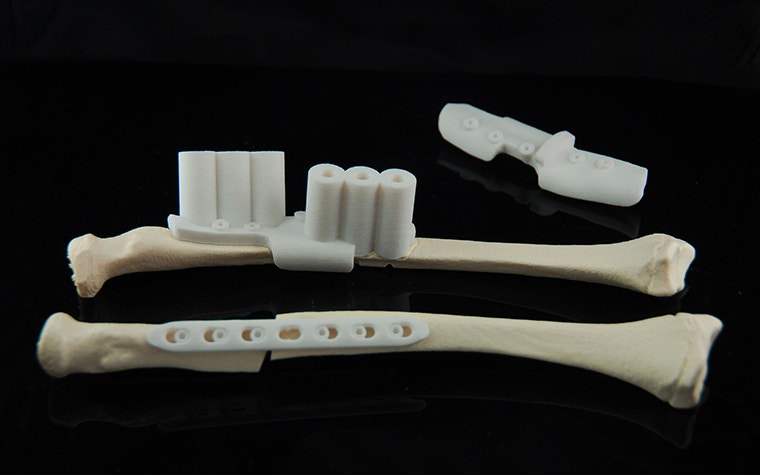 3D-printed bone replicas with attached surgical guides, designed to assist in precise drilling and implantation during orthopaedic procedures.
