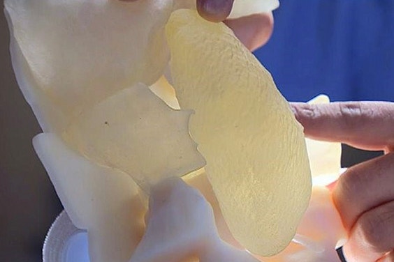 3D printed kidney model