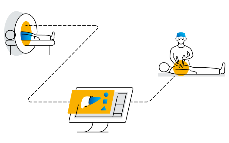 Illustration of a medical workflow connecting MRI imaging, surgical planning software for hepatic surgery, and a clinician performing a procedure on a patient.