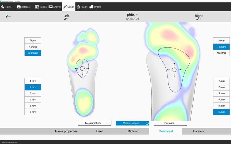 Screenshot showing how to use metatarsal corrections in footscan