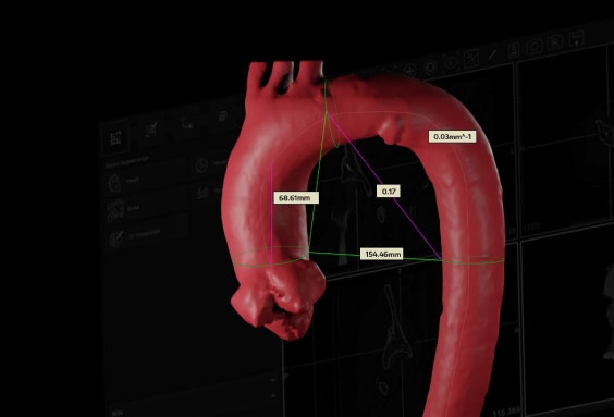 Digitales Bild der Anatomie mit Abstandsmarkierungen zwischen verschiedenen Punkten