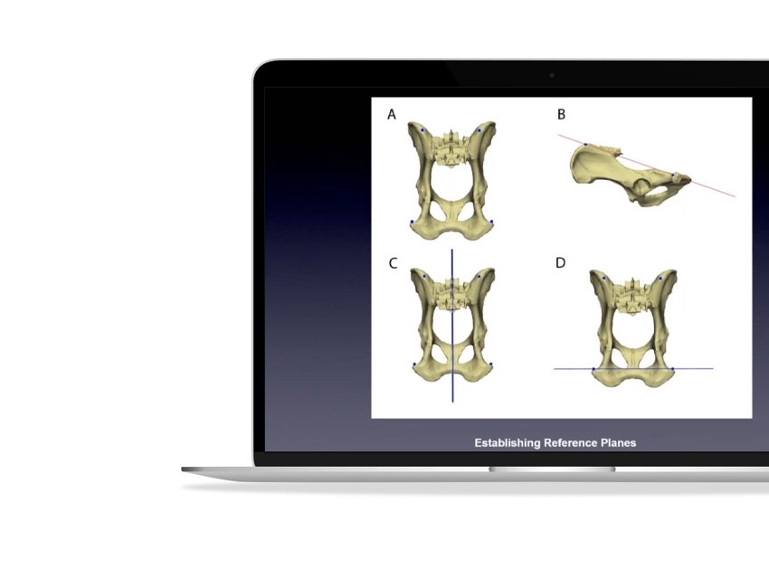 ssd-dog-bone-measurements-estabilishing-reference-planes.jpg