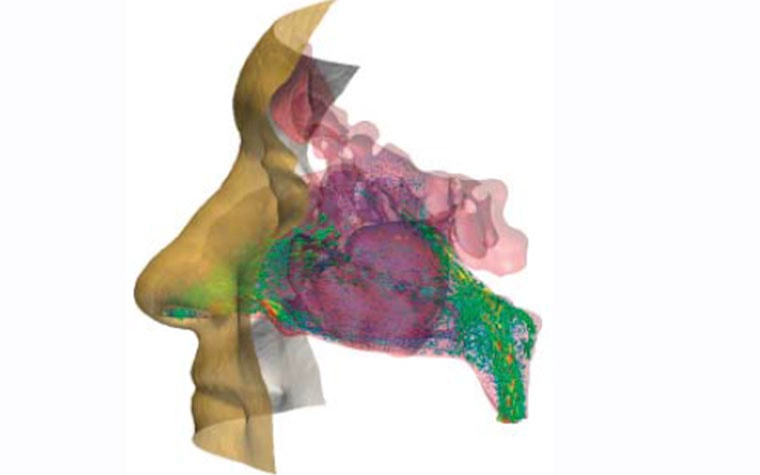 Virtual side view of a patient's face