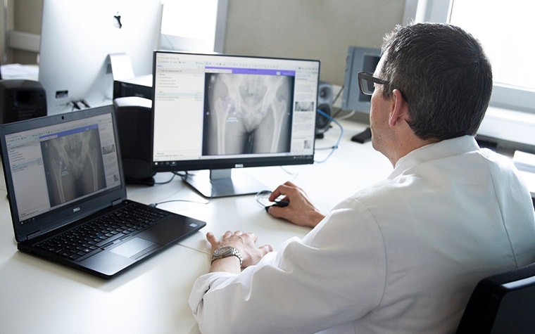 Consultant Orthopaedic Surgeon Dr. Ross Barker looking using OrthoView to review xray images of hip joints on a laptop screen 