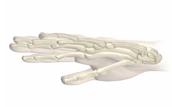 Digital image of bones in a human hand
