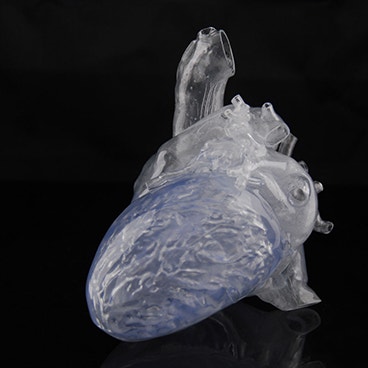 心臓の3Dプリントモデルが16歳の心臓腫瘍患者の治療を支援