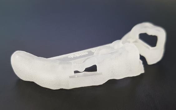 3D-printed dental implant