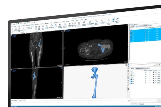 Imagen de la anatomía de un hueso en diferentes formatos digitales dentro de Magics en una pantalla de ordenador