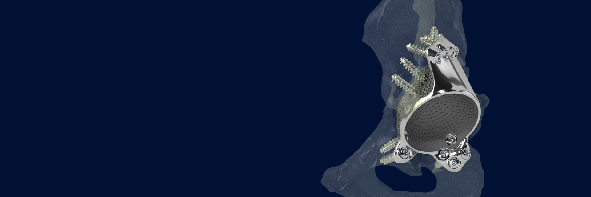 hd-materialise-amace-hip-implant-render.jpg