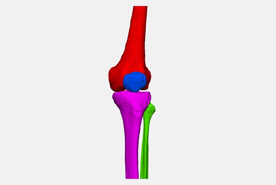 Modelo tridimensional de la anatomía de una rodilla segmentada