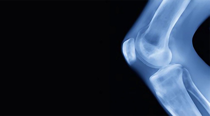 Digital anatomy scan of a joint on a black background
