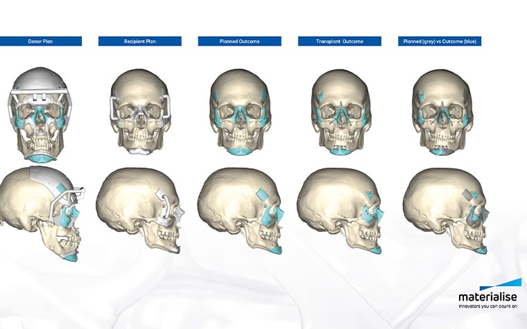 3D models of some skulls