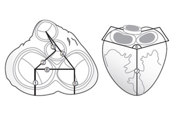 3D models aligned using a common coordinate system to derive meaningful measurements from the virtual analysis 