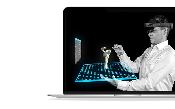 A laptop screen showing a man wearing Microsoft Hololens uses Mimics Viewer's augmented reality feature to examine a hip and hip implant model