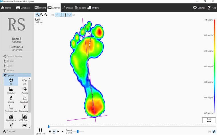 cimq-footscan-technology-reveals-biomechanics-software.jpg