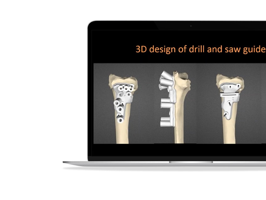 ssd-3d-models-of-drill-saw-guides.jpg