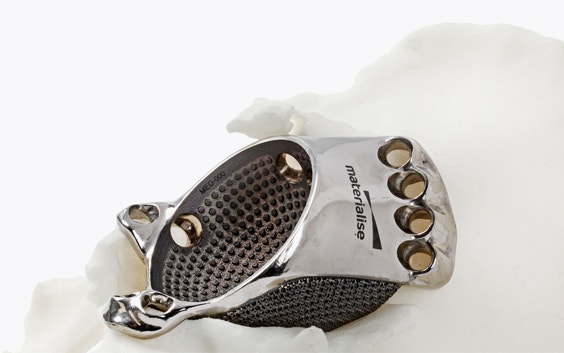 Close-up view of a metal 3D-printed implant in a hip model