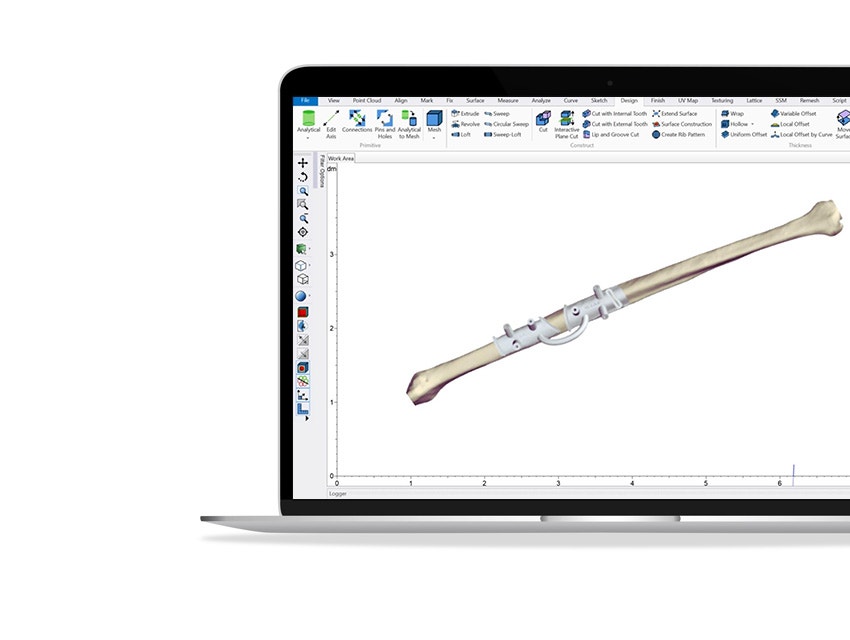 Mimics Innovation Suite software showing on a computer screen with a 3D model of a bone and a personalized surgical guide
