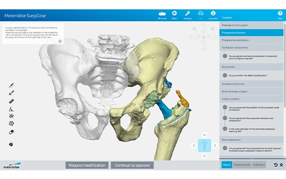 Digitales 3D-Modell eines Beckens mit einer Hüfte und einem Oberschenkel in Farbe