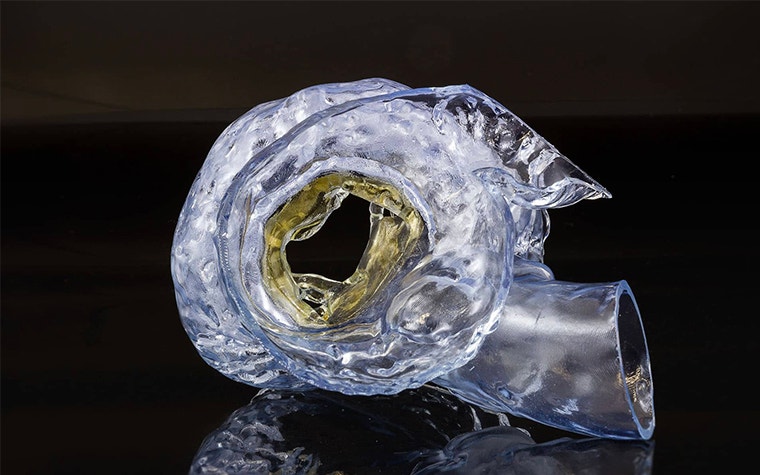 3D-printed, translucent model of the mitral valve 