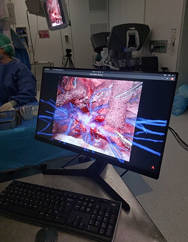 A screen of a desktop computer in an operating room, displaying the patient's lung anatomy, with virtual branches extending off the visual to visualize more anatomy not seen in the image.