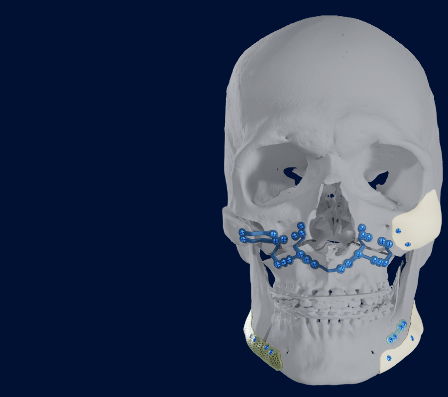 Orthognathic surgery