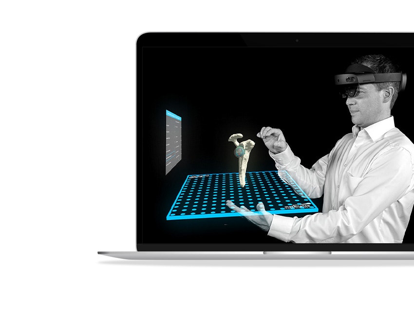 A laptop screen showing a man wearing Microsoft Hololens uses Mimics Viewer's augmented reality feature to examine a hip and hip implant model