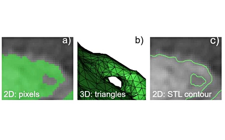 From the 2D data (a), an STL was created (b), whose contours could be compared with the 2D image tab (c). 
