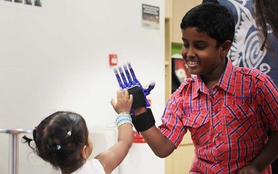 Padmaloshn high fiving with little sister with his prosthetic hand