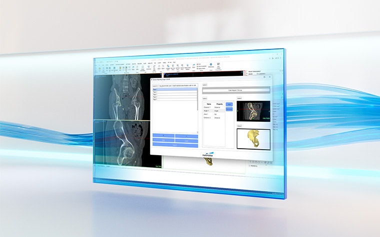 A screen showing patient anatomy within software from the Materialise Mimics platform with the Generic Reporting Plugin pulled up on a white reflective background with blue lines