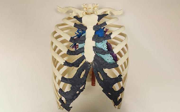 Ein 3D-gedrucktes Modell des menschlichen Brustkorbs und Gefäßsystems