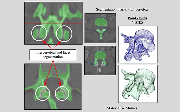 3D reconstruction of the 4th lumbar vertebra from segmentation masks (point clouds)