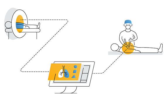 Cartoon graphic showing the full workflow, from patient scan to 3D planning to surgery