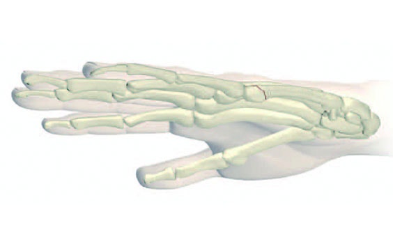 Digital image of hand bones showing through a hand