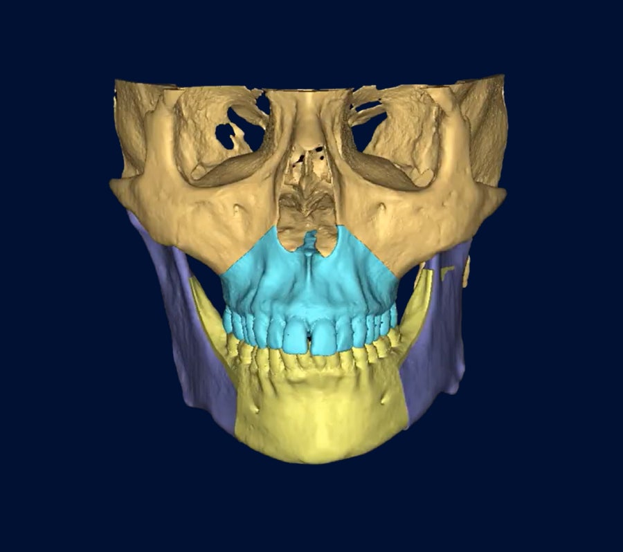 3D planning autonomy