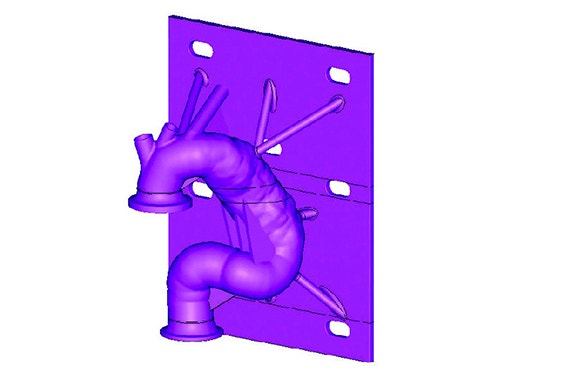 Patient-based aortic model 